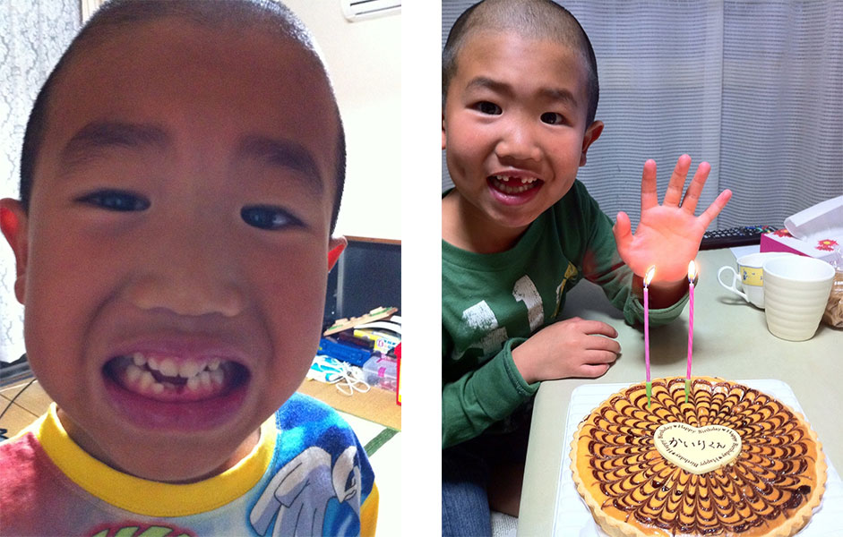 歯の生え変わり-1