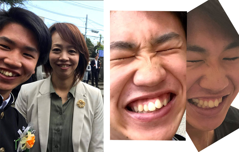 歯の生え変わり-2